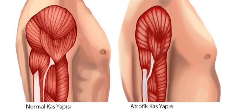 Kas Kaybını Önlemeye Yardımcı Supplement Kombinasyonu