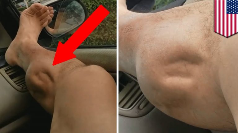 Antrenman Sonrası Kas Ağrısını Yok Etmenin Yolları