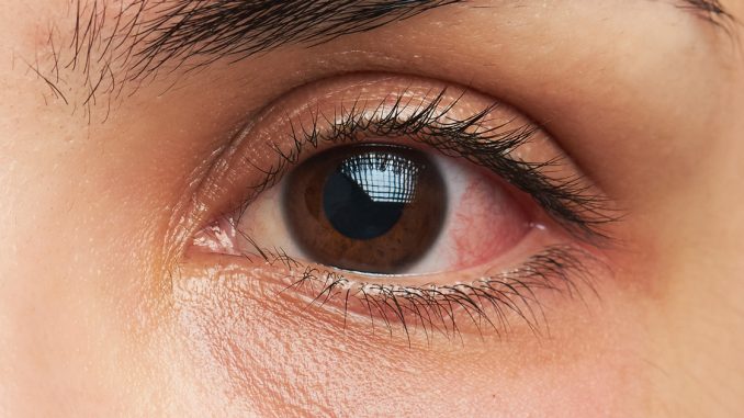 eye-infection-1200x630